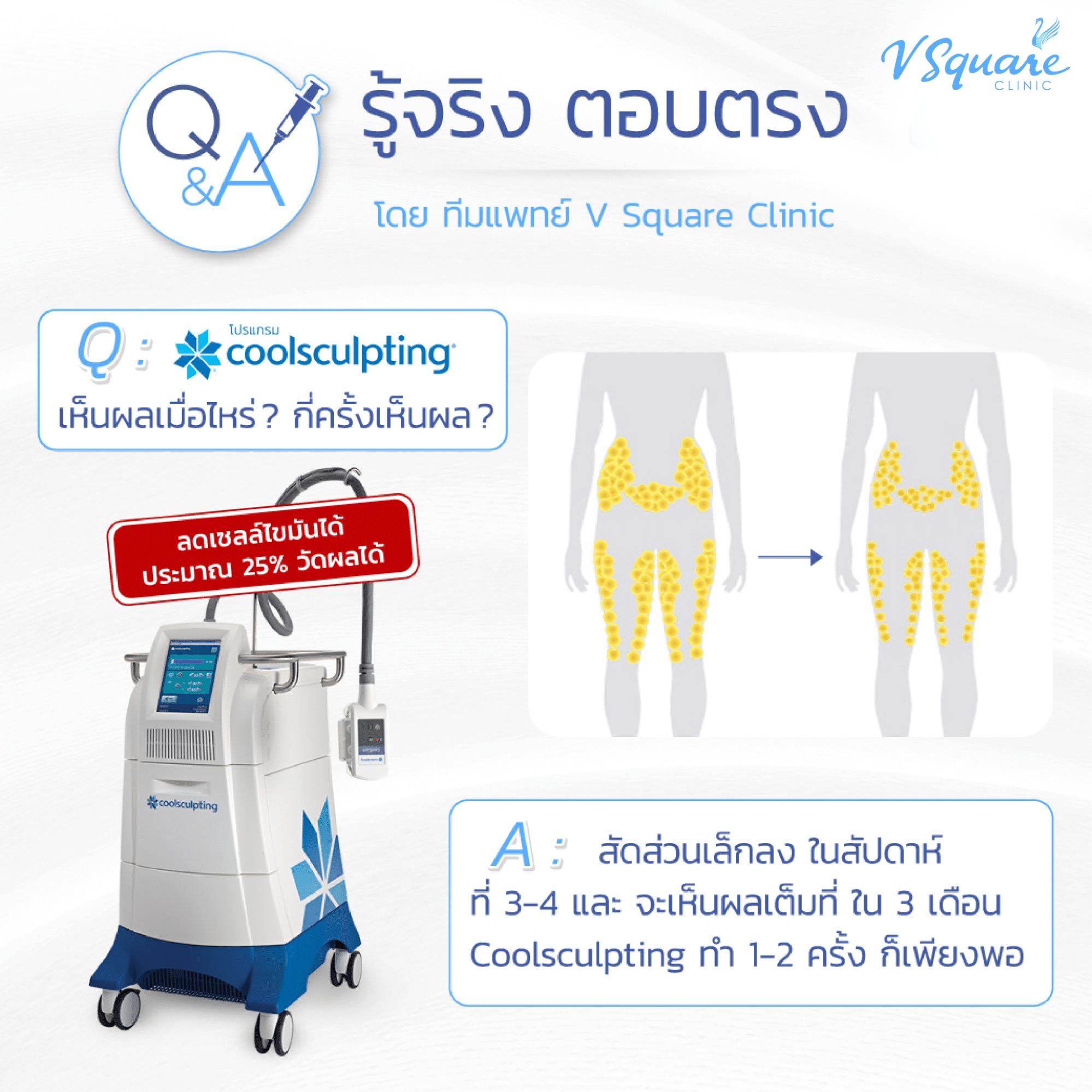 Coolsculpting ต้องทำกี่ครั้งจึงจะเห็นผล