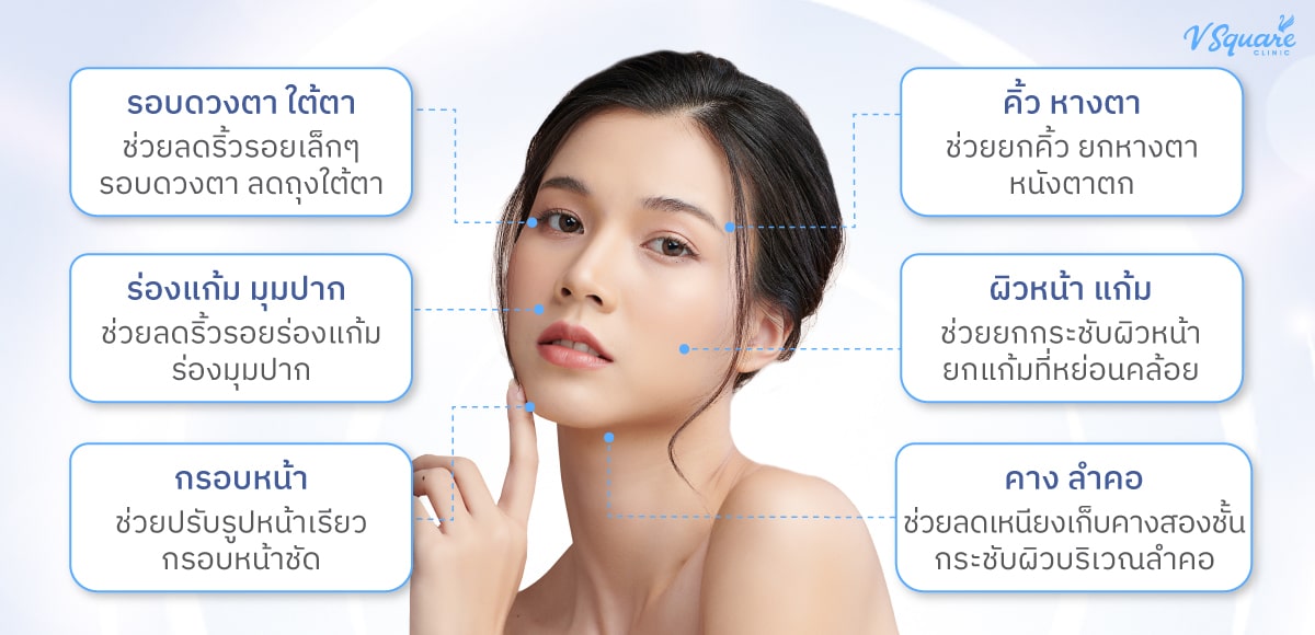 Hifu-ทำตำแหน่งไหนได้บ้าง
