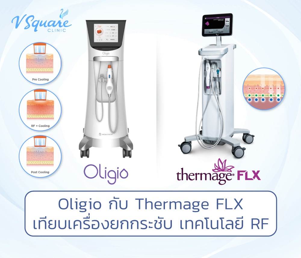 Oligio กับ Thermage