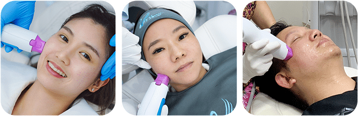 Thermage FLX เหมาะกับใครบ้าง