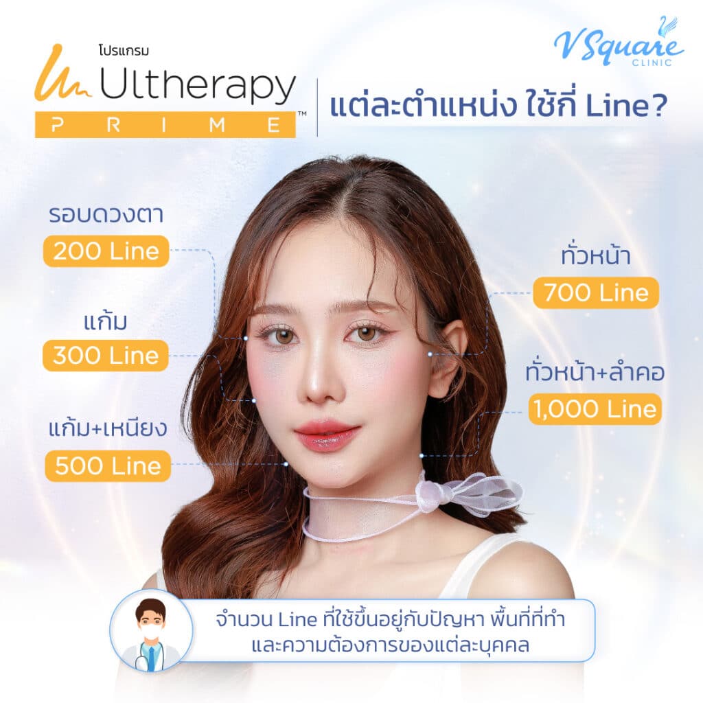Ulthera ทั่วหน้า แต่ละตำแหน่งใช้กี่ไลน์