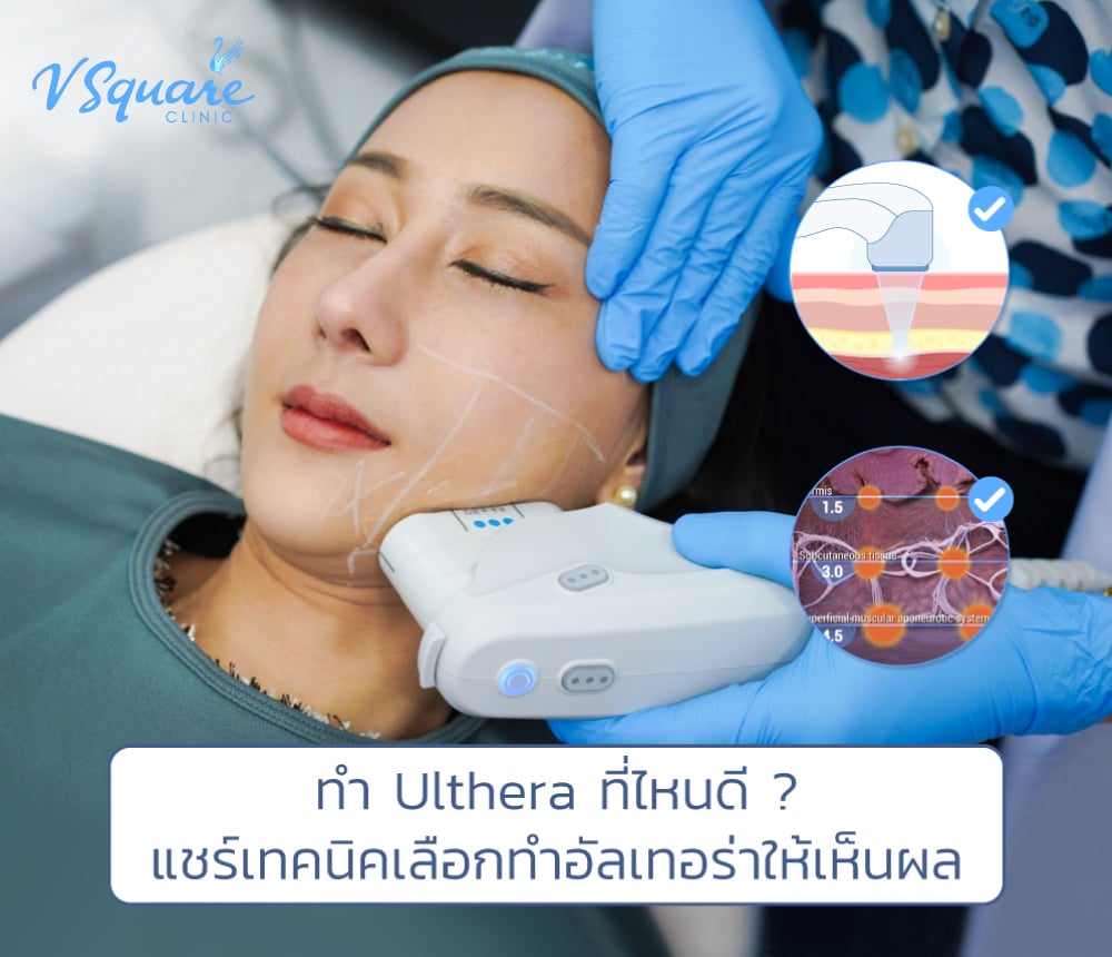 Ulthera ที่ไหนดี