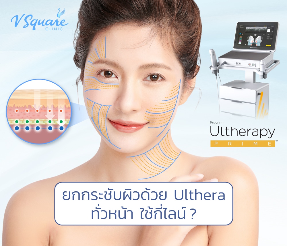 Ulthera หน้า ใช้กี่ช็อต_ไลน์