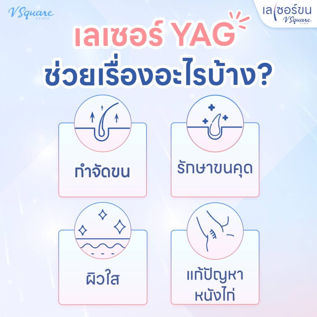 Yag Laser ดีอย่างไร