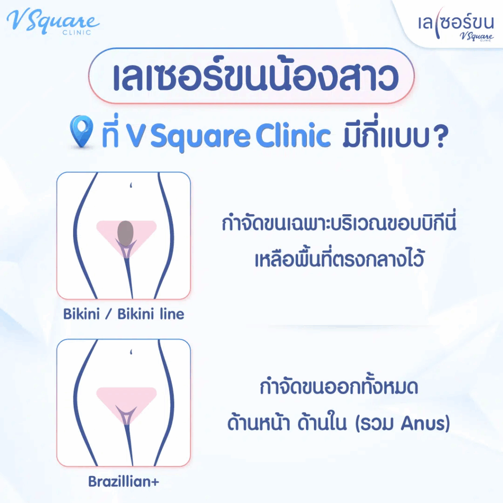 เลเซอร์บิกินี่ มีกี่แบบ