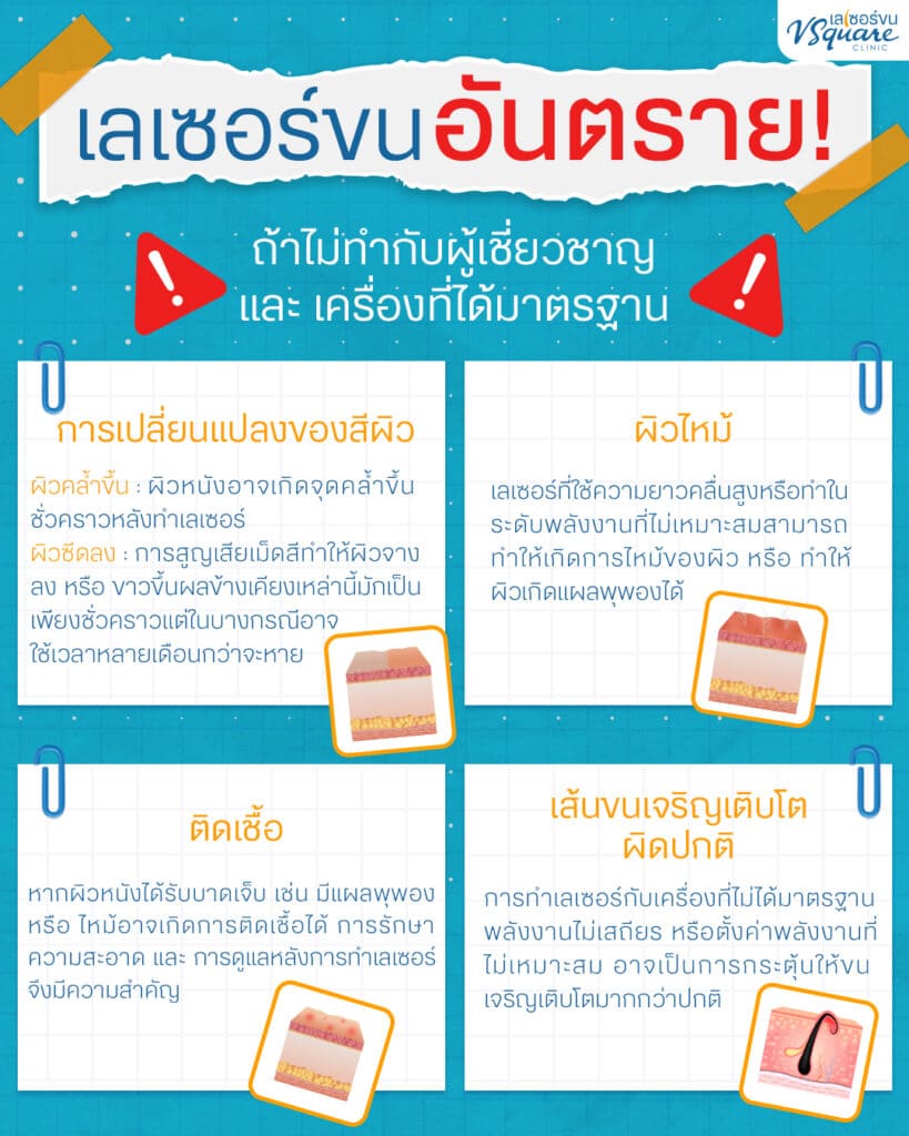 เลเซอร์ขนหน้า อันตรายไหม