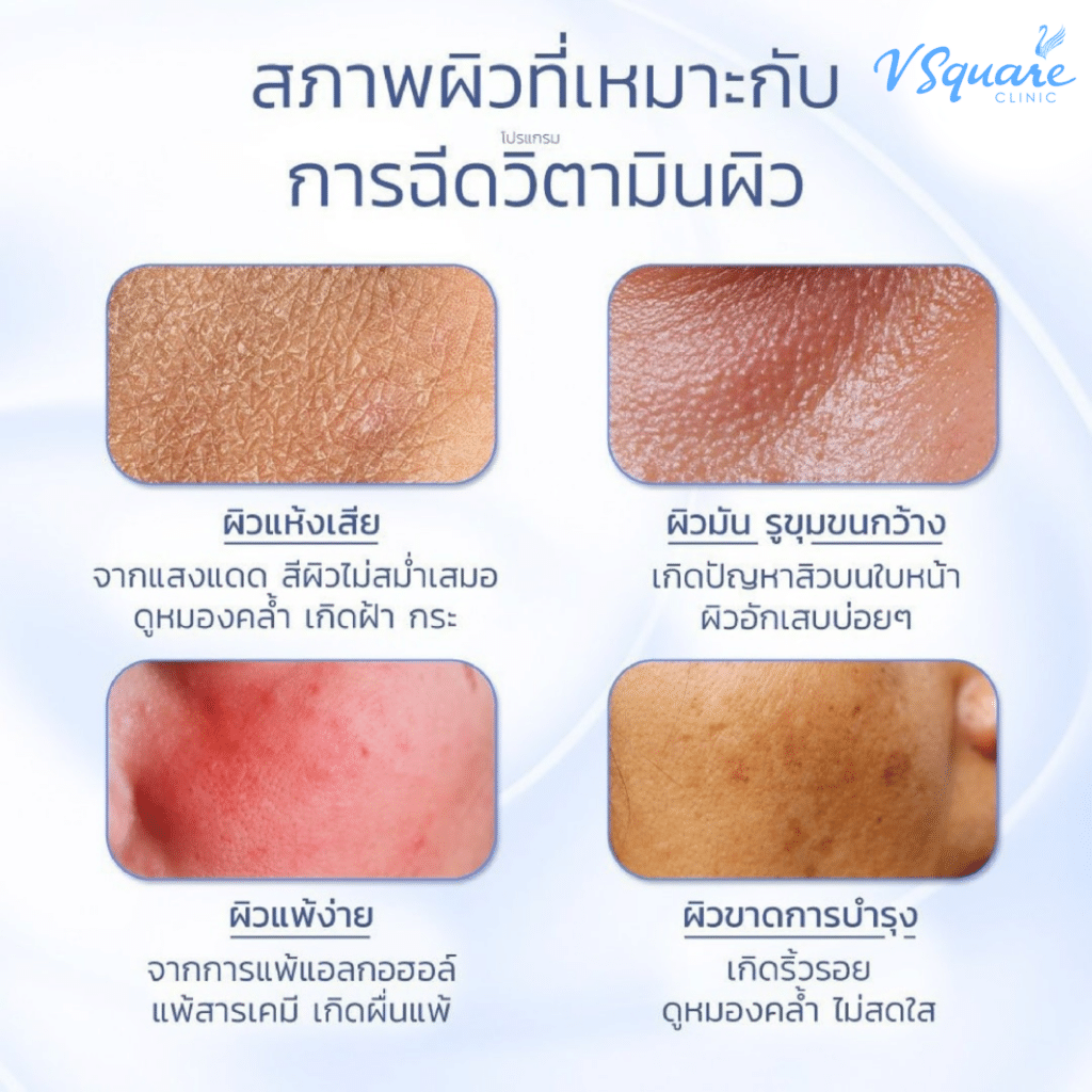 การดริปวิตามิน เหมาะกับผิวแบบไหน