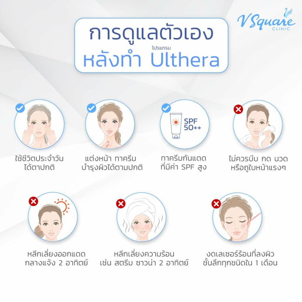 การปฏิบัติตัวหลังทำ Ulthera