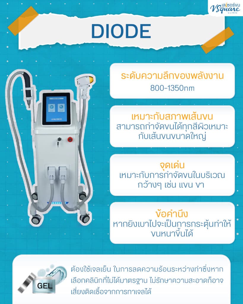 กำจัดขน diode laser