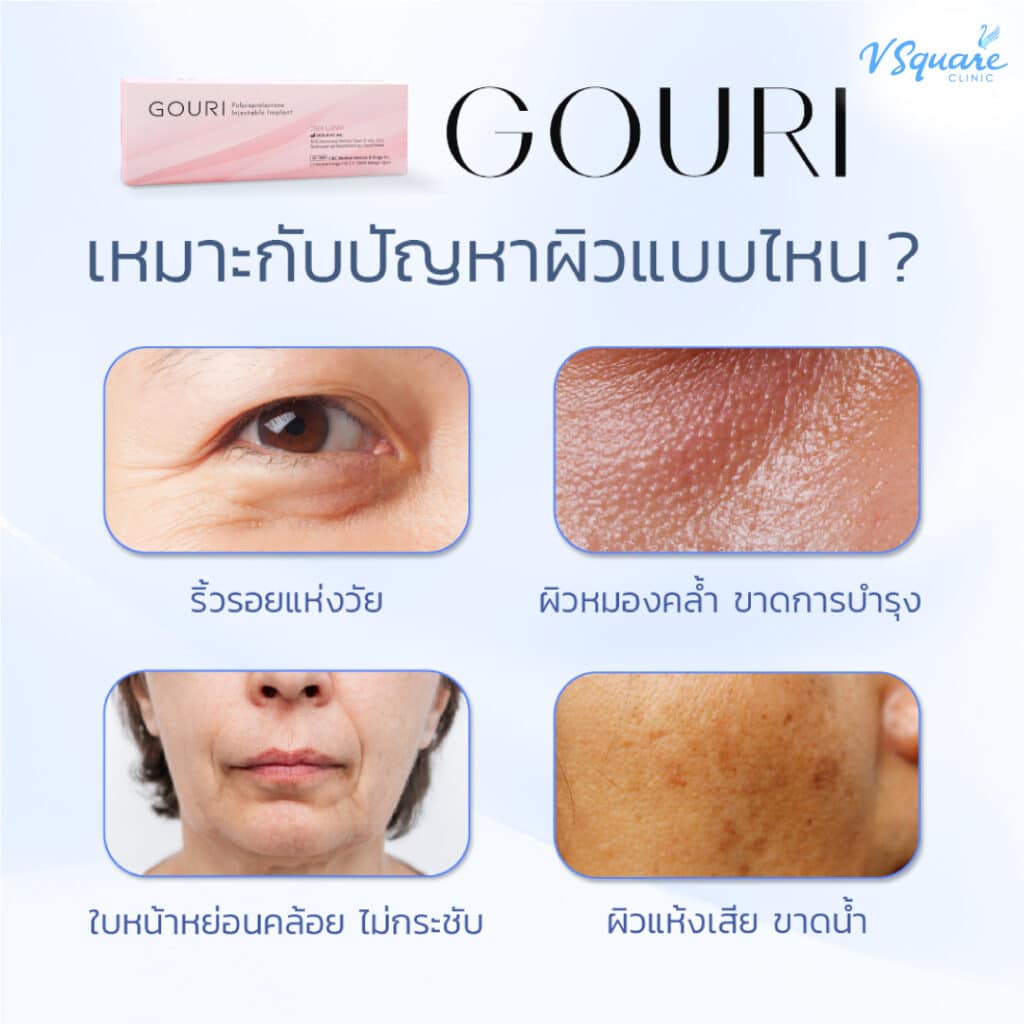 กูริเหมาะกับใคร