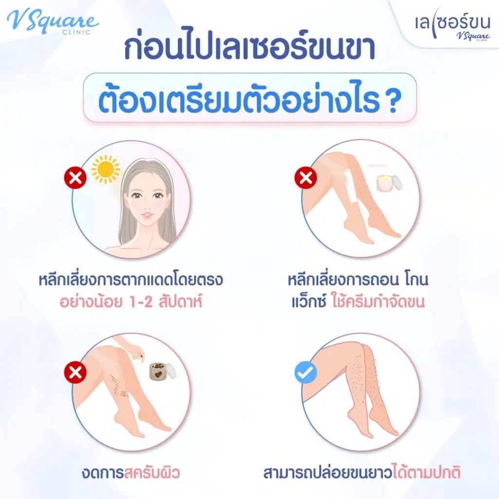 ก่อนเลเซอร์ขนขา