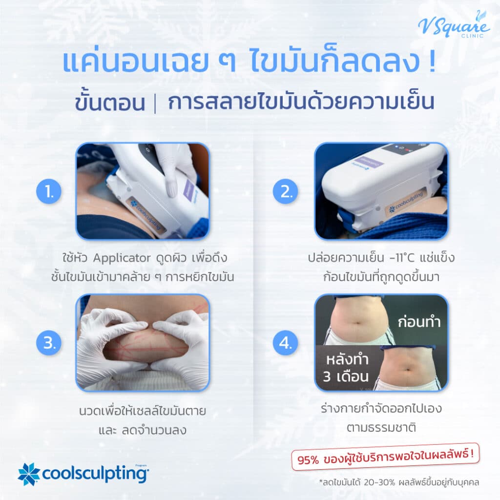 ขั้นตอนทำ Coolsculpting