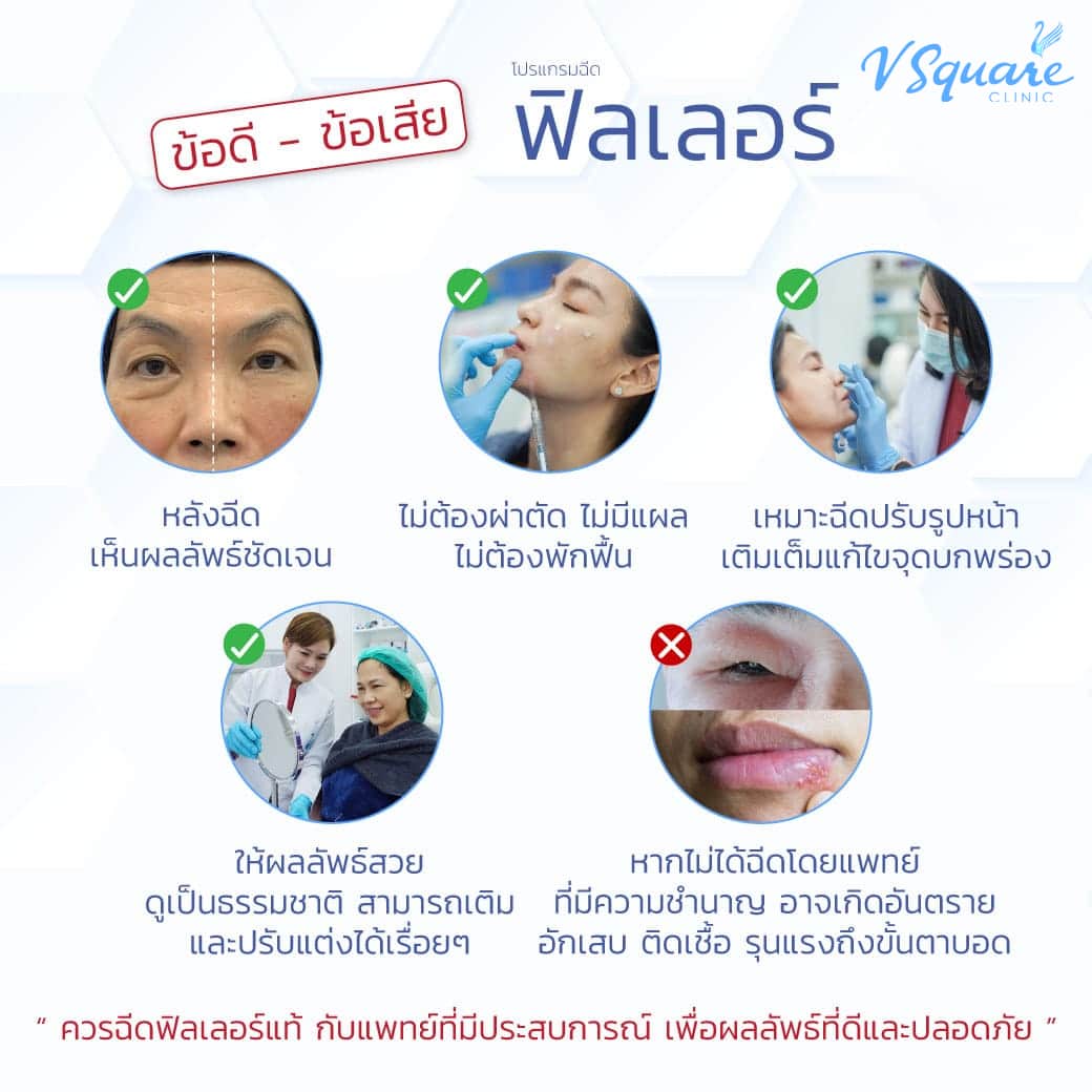 ข้อดี ข้อเสียของการฉีดฟิลเลอร์
