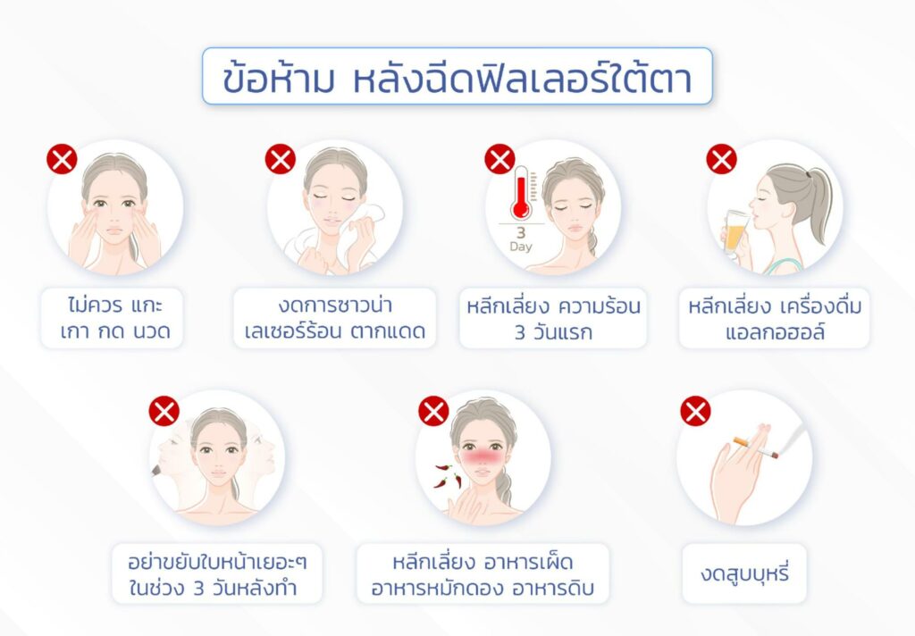 ข้อห้ามหลังฉีดฟิลเลอร์ใต้ตา