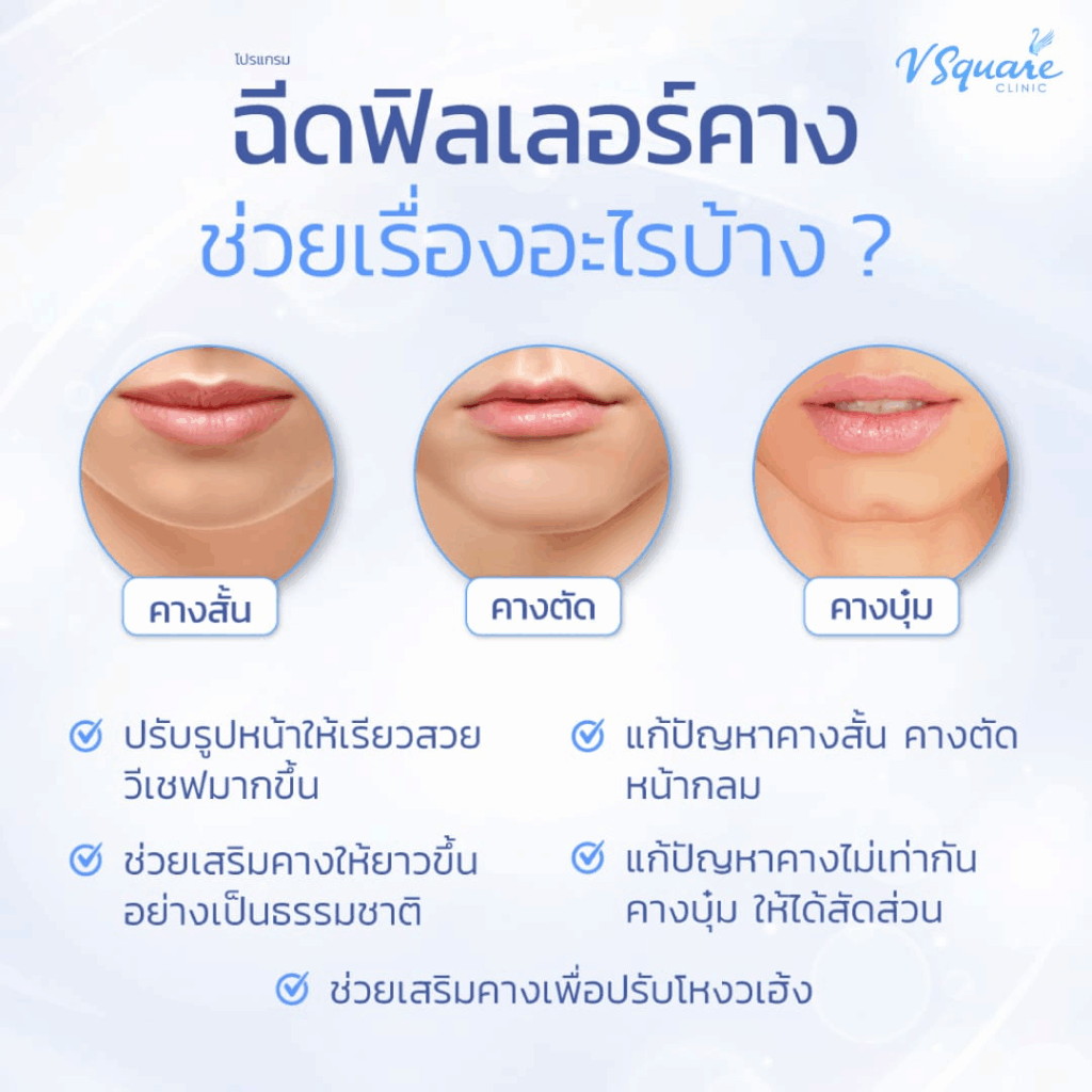 ฉีดฟิลเลอร์คาง ช่วยแก้ปัญหาเรื่องอะไร