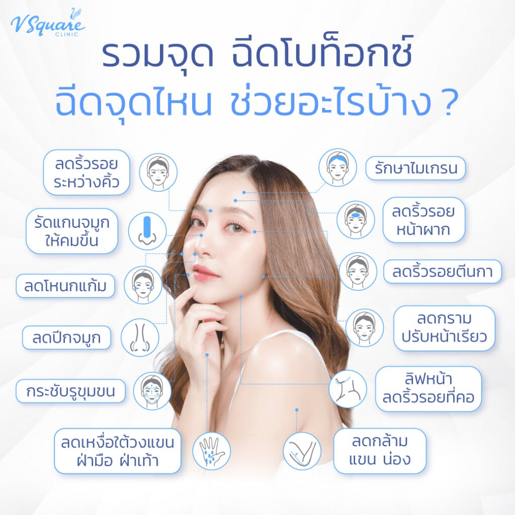 ฉีดโบท็อกจุดไหนได้บ้าง