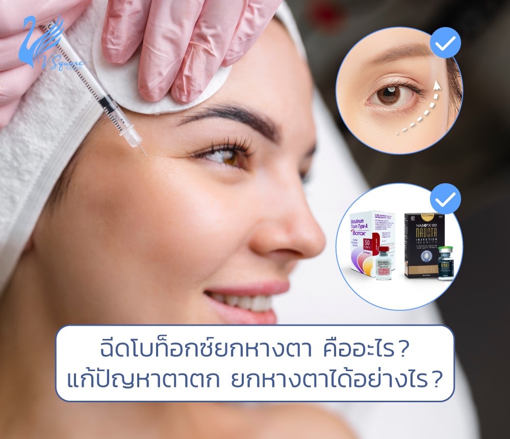 ฉีดโบท็อกยกหางตา