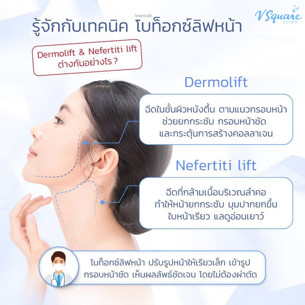 ฉีดโบท็อกลิฟกรอบหน้า