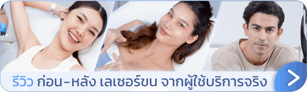 ดูรีวิวเลเซอร์ขนที่ V Square Clinic