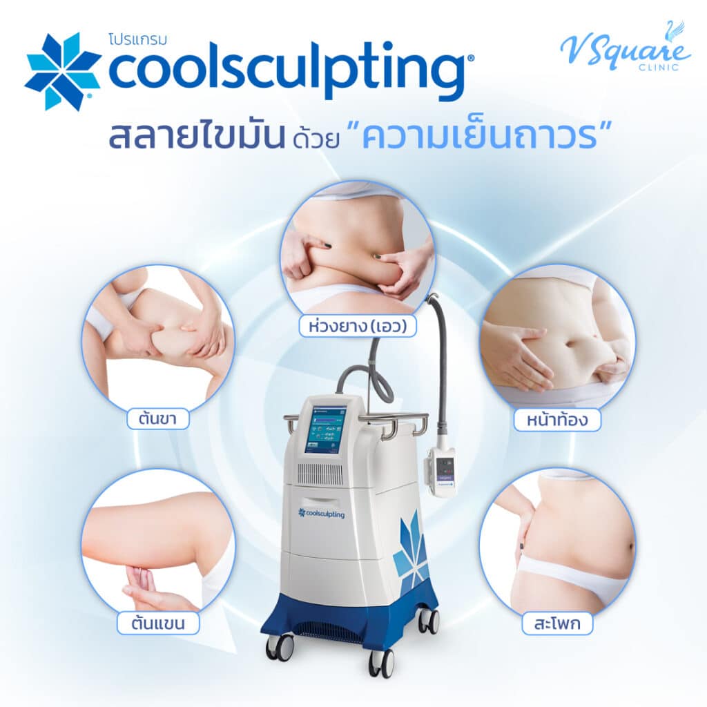 ตำแหน่งการทำ Coolsculpting