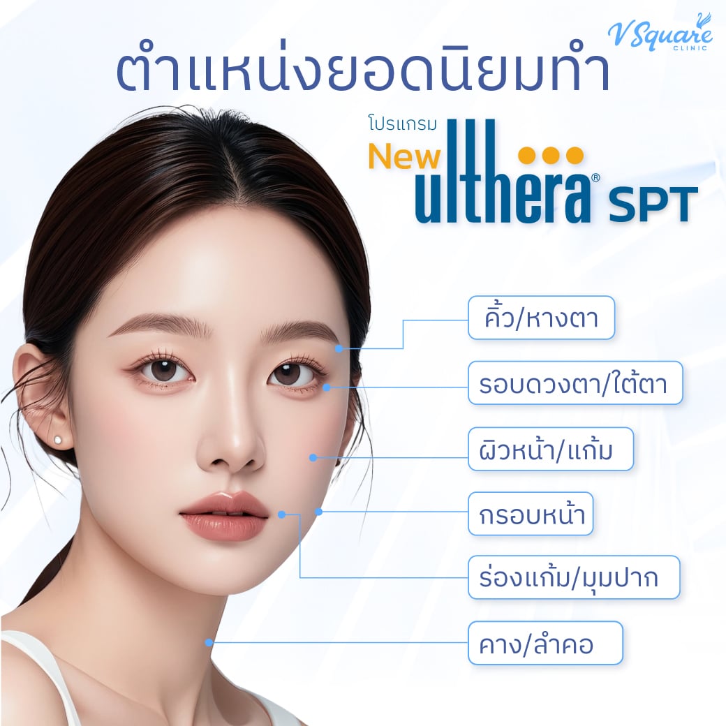ตำแหน่งยอดนิยมทำ--Ulthera-SPT2
