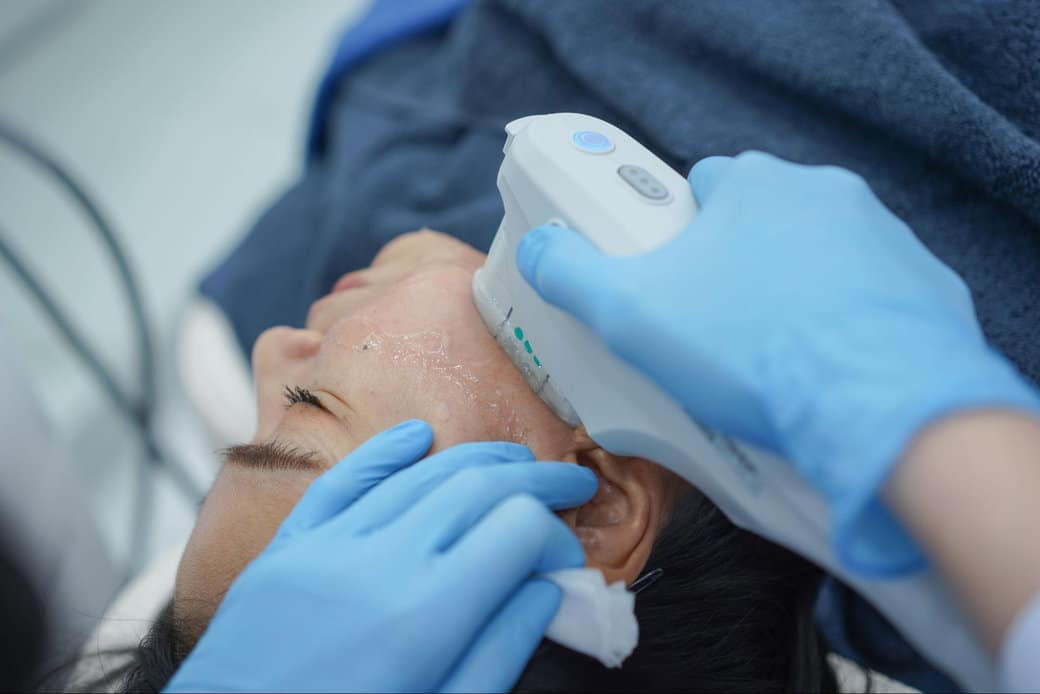 ทำ Ulthera ราคา ที่ V Square Clinic