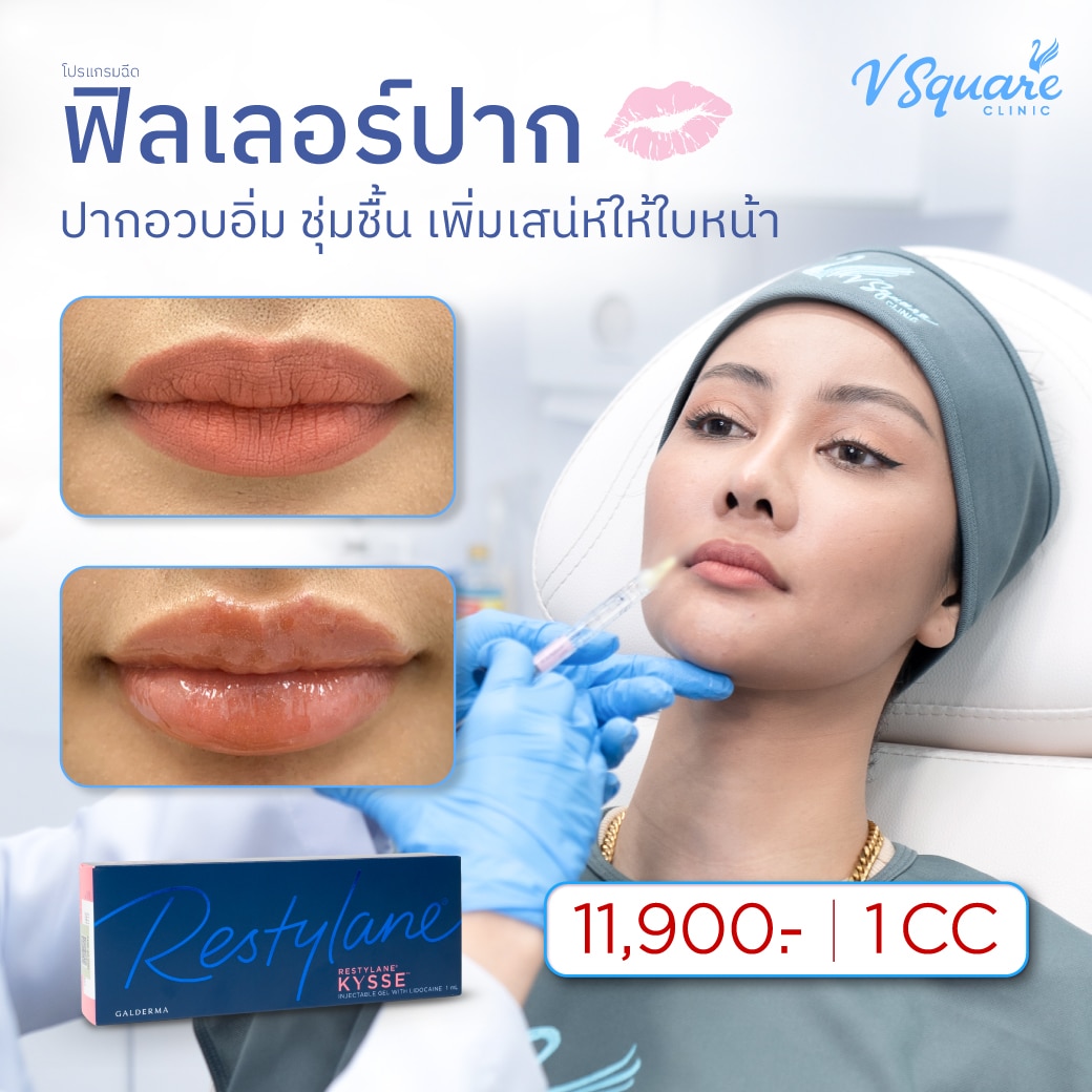 ฟิลเลอร์ปาก