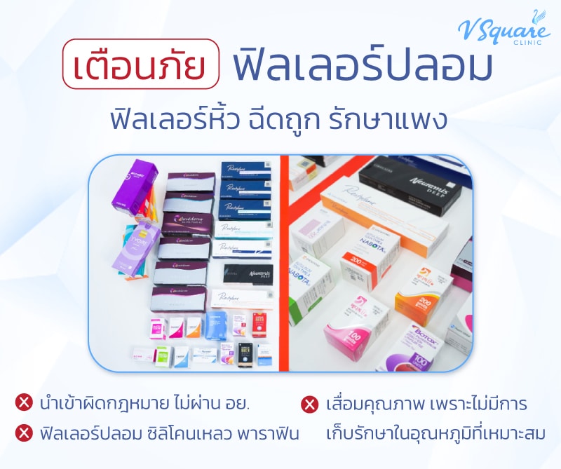 ฟิลเลอร์ราคาถูก