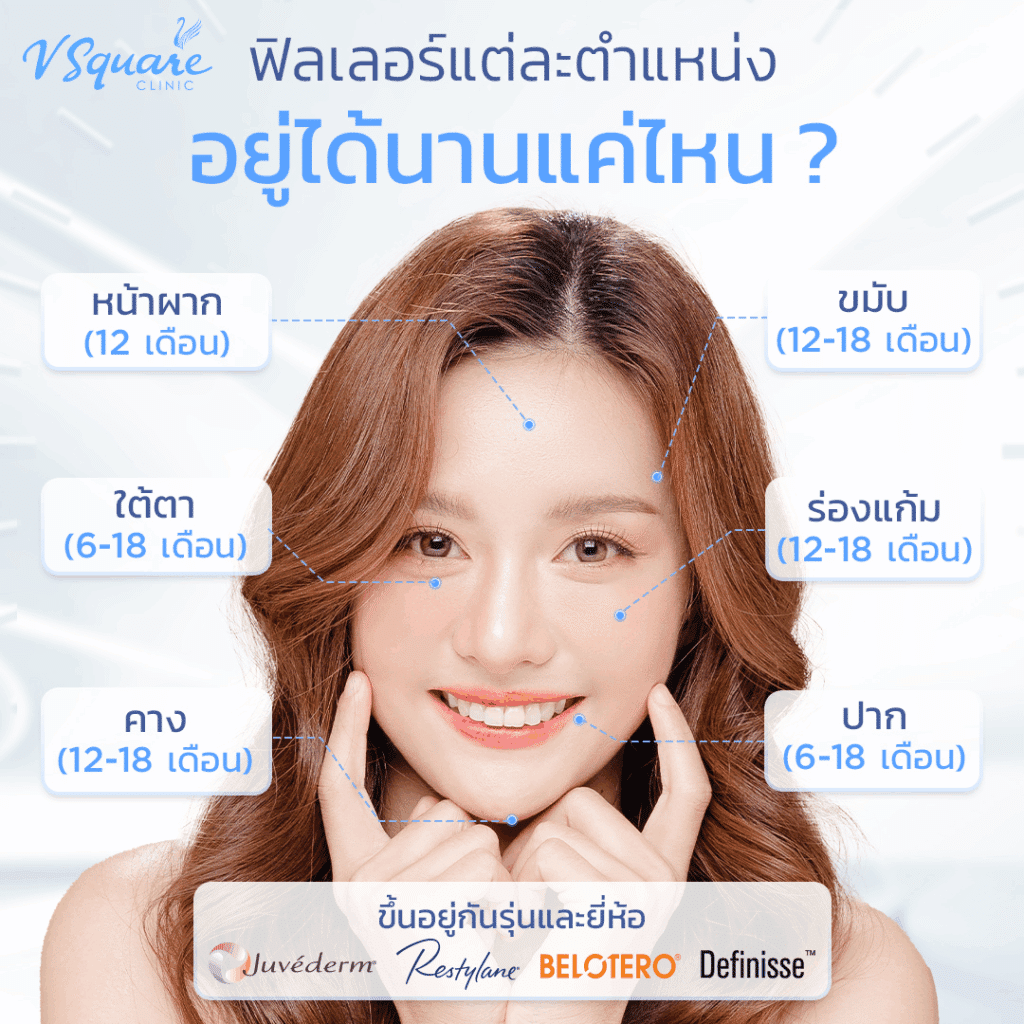ฟิลเลอร์อยู่ได้นานแค่ไหน