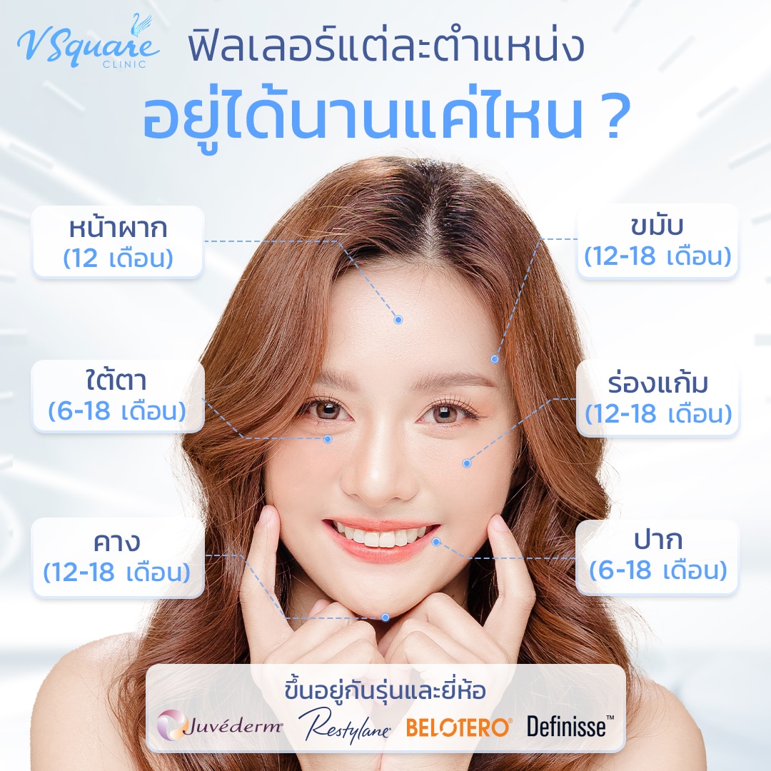 ฟิลเลอร์อยู่ได้นานไหมแต่ละตำแหน่ง