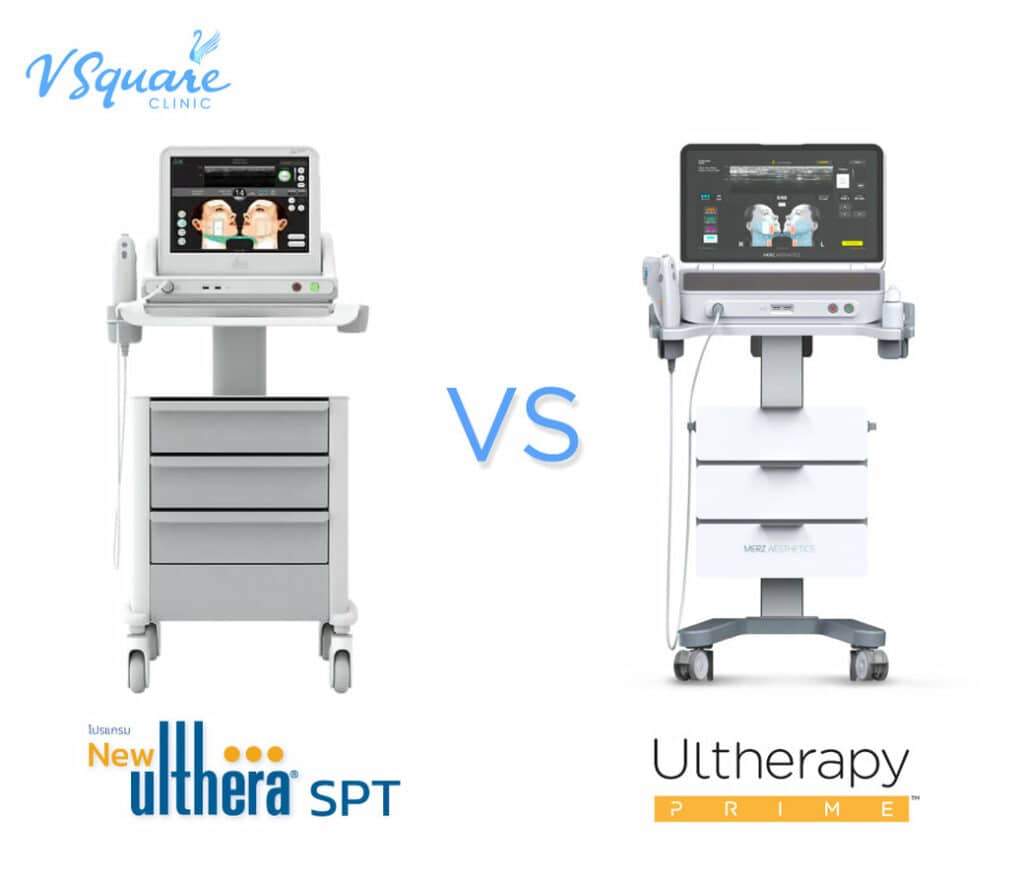 ราคา Ulthera SPTและ Ulthera Prime