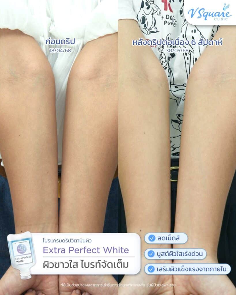 รีวิวดริปวิตามินผิว