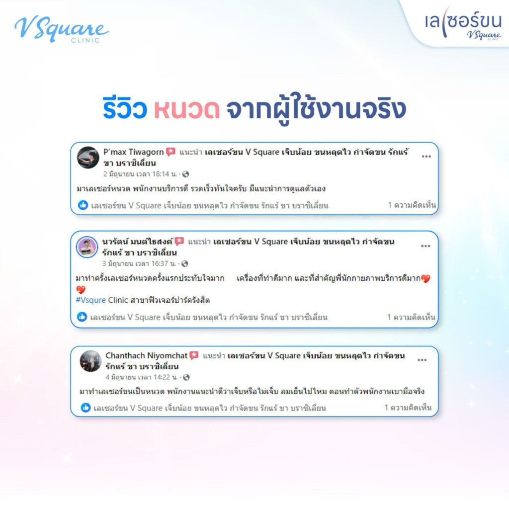 รีวิวเลเซอร์หนวด
