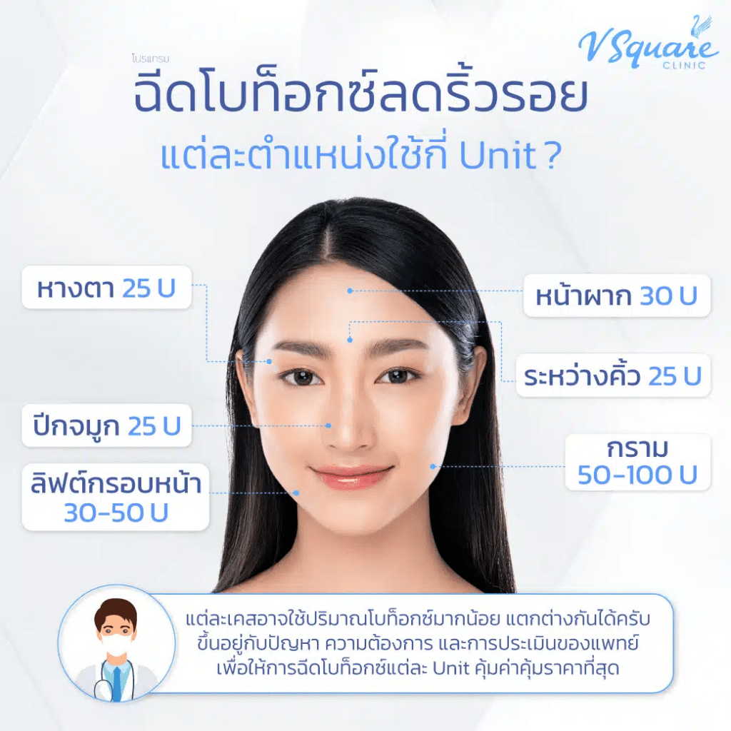 ลิฟกรอบหน้าใช้กี่ยูนิต