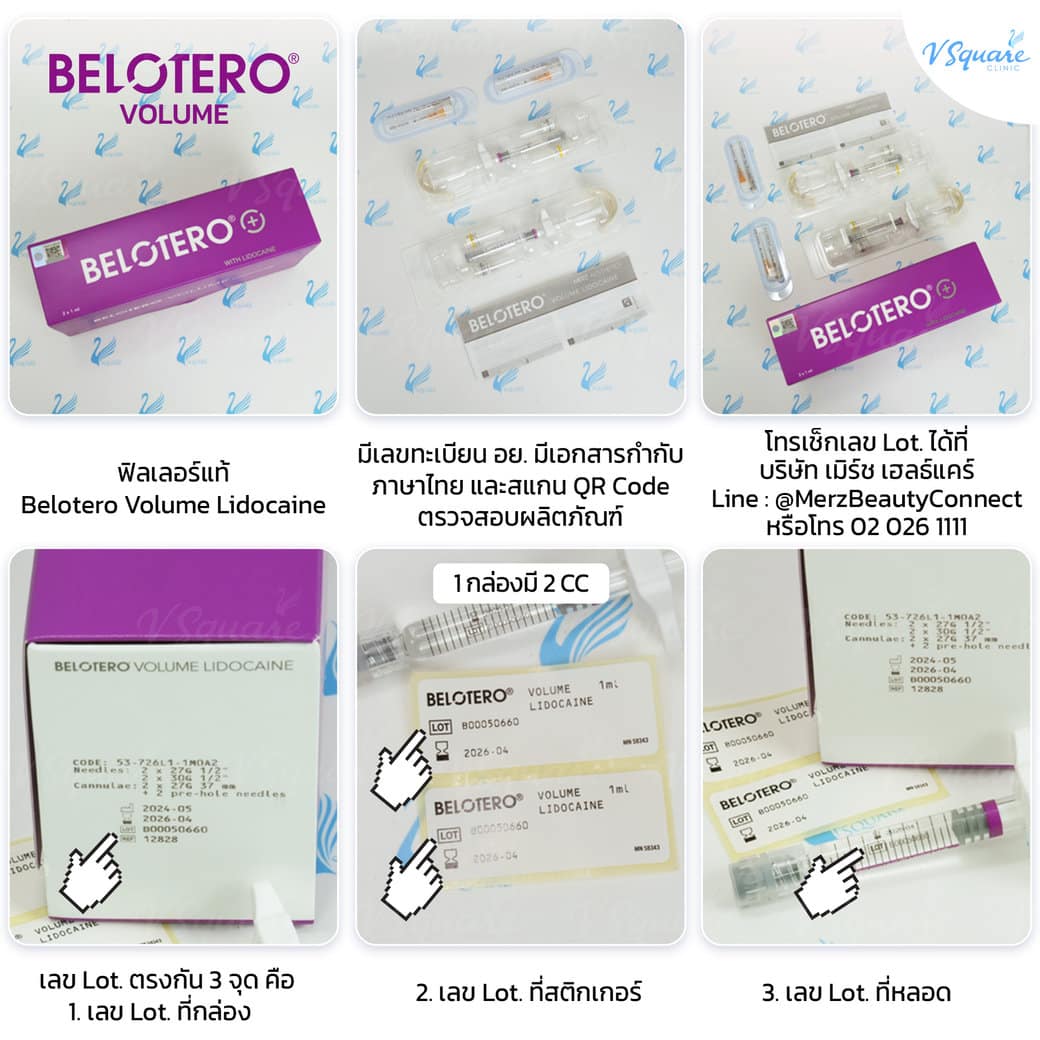 วิธีเช็กฟิลเลอร์ของแท้ Belotero Volume