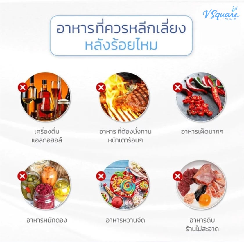 หลังร้อยไหม