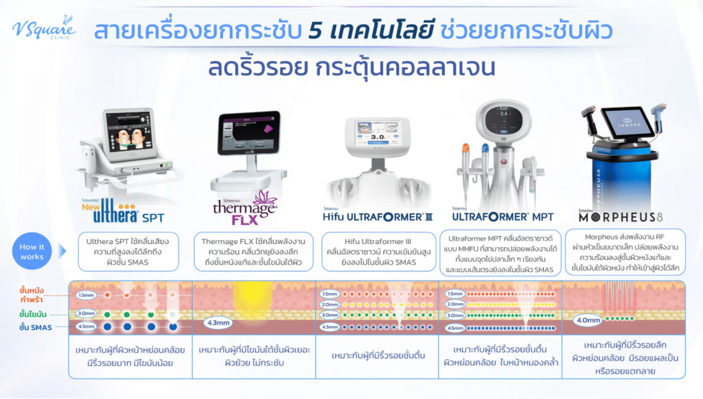 เปรียบเทียบเครื่องยกกระชับ