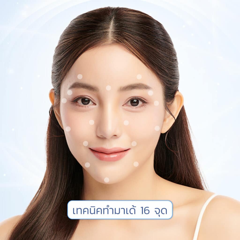 เมโสหน้าใส 16 จุด