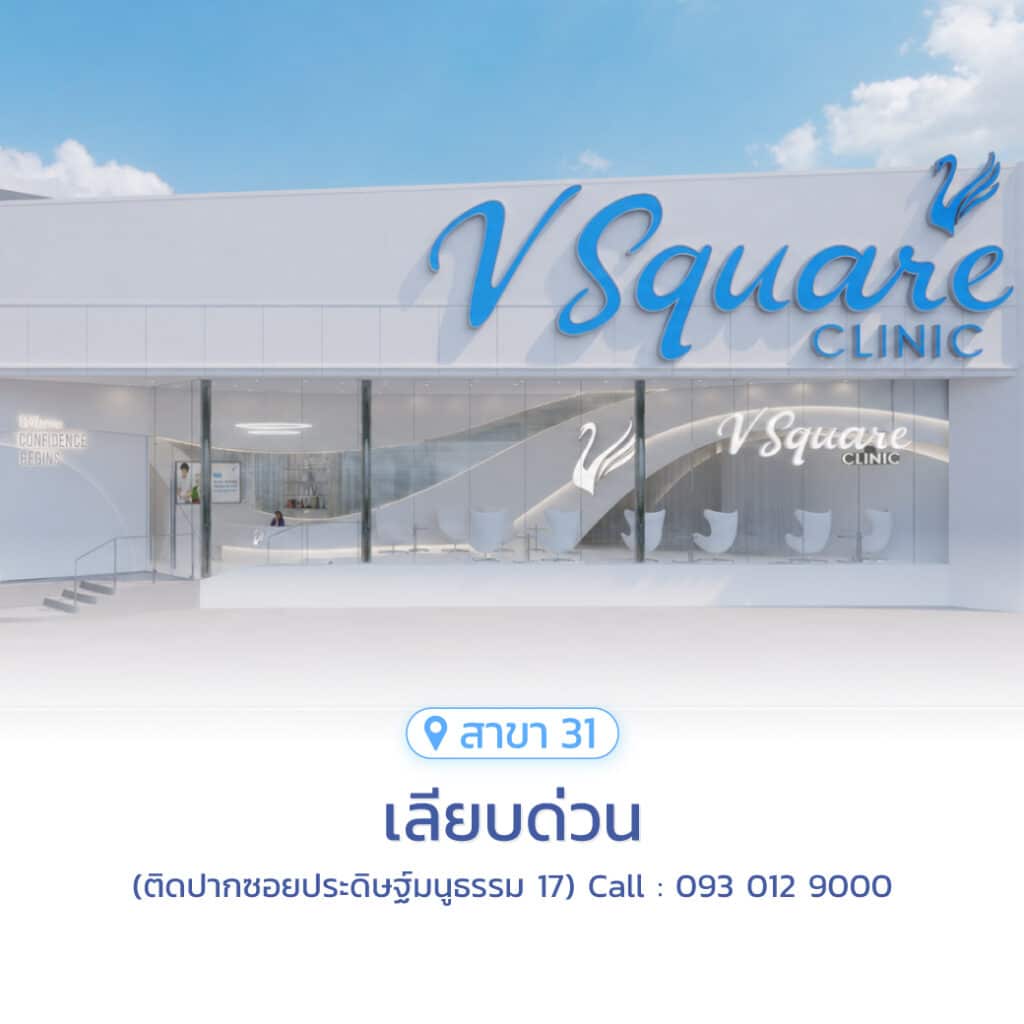 เลียบด่วน