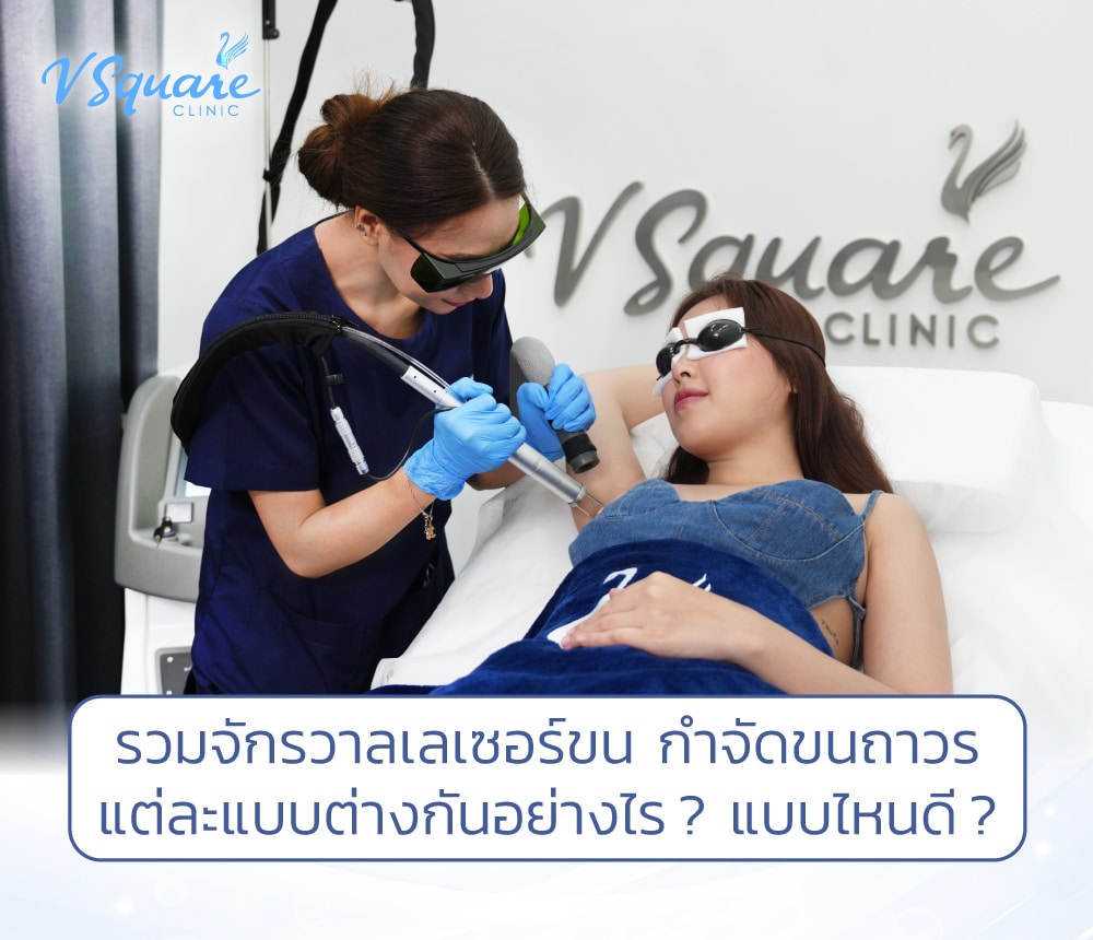 เลเซอร์ขน กำจัดขน
