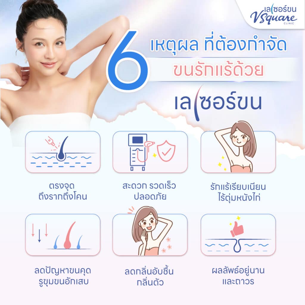 เลเซอร์ขนรักแร้ ข้อดี