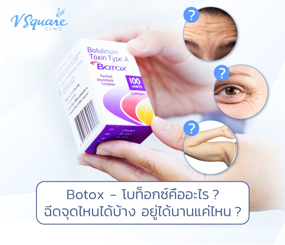 โบท็อก