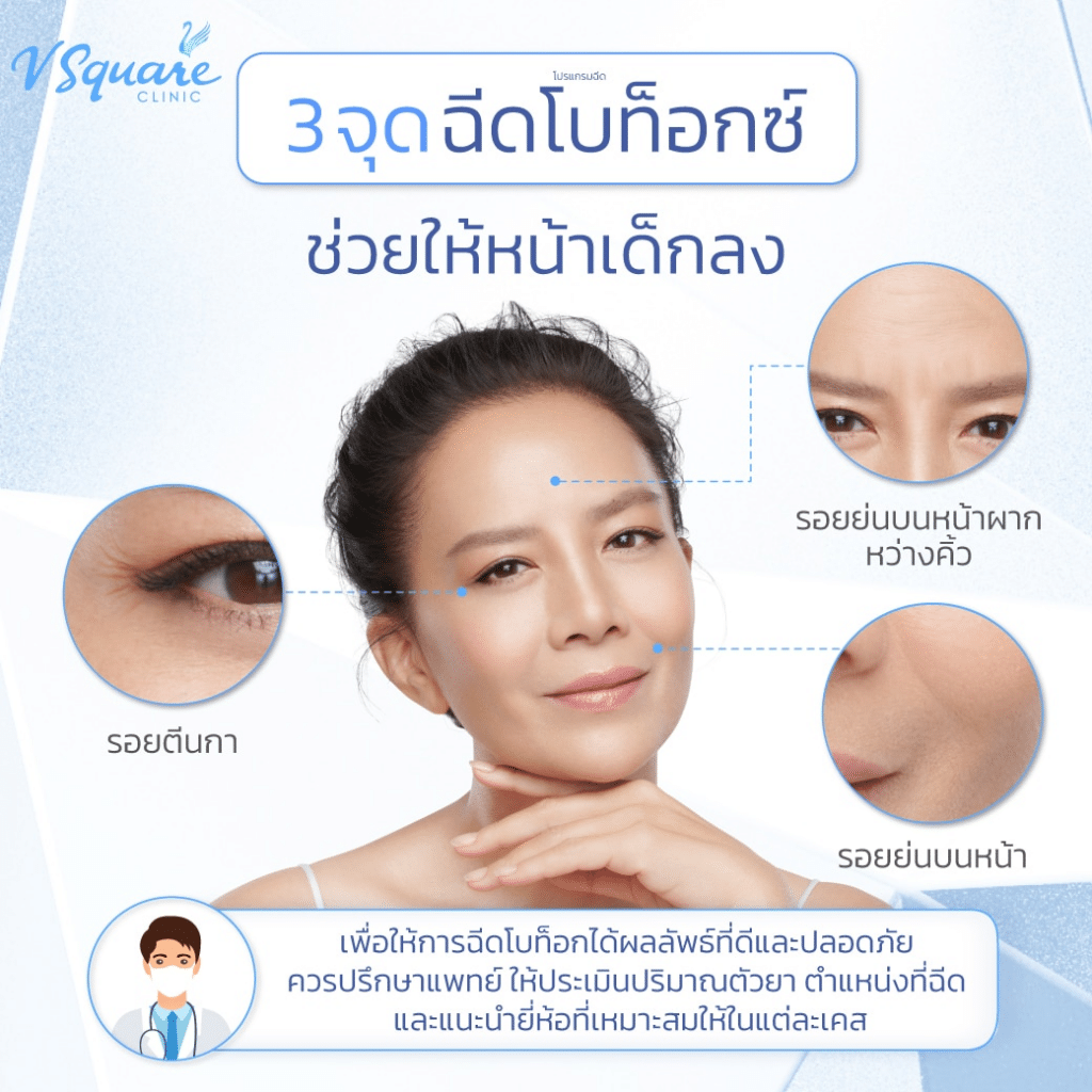 โบท็อกริ้วรอย