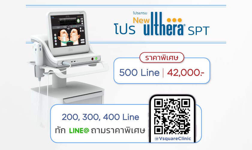 โปร_SPT_ปกติ_07JAN25_TH