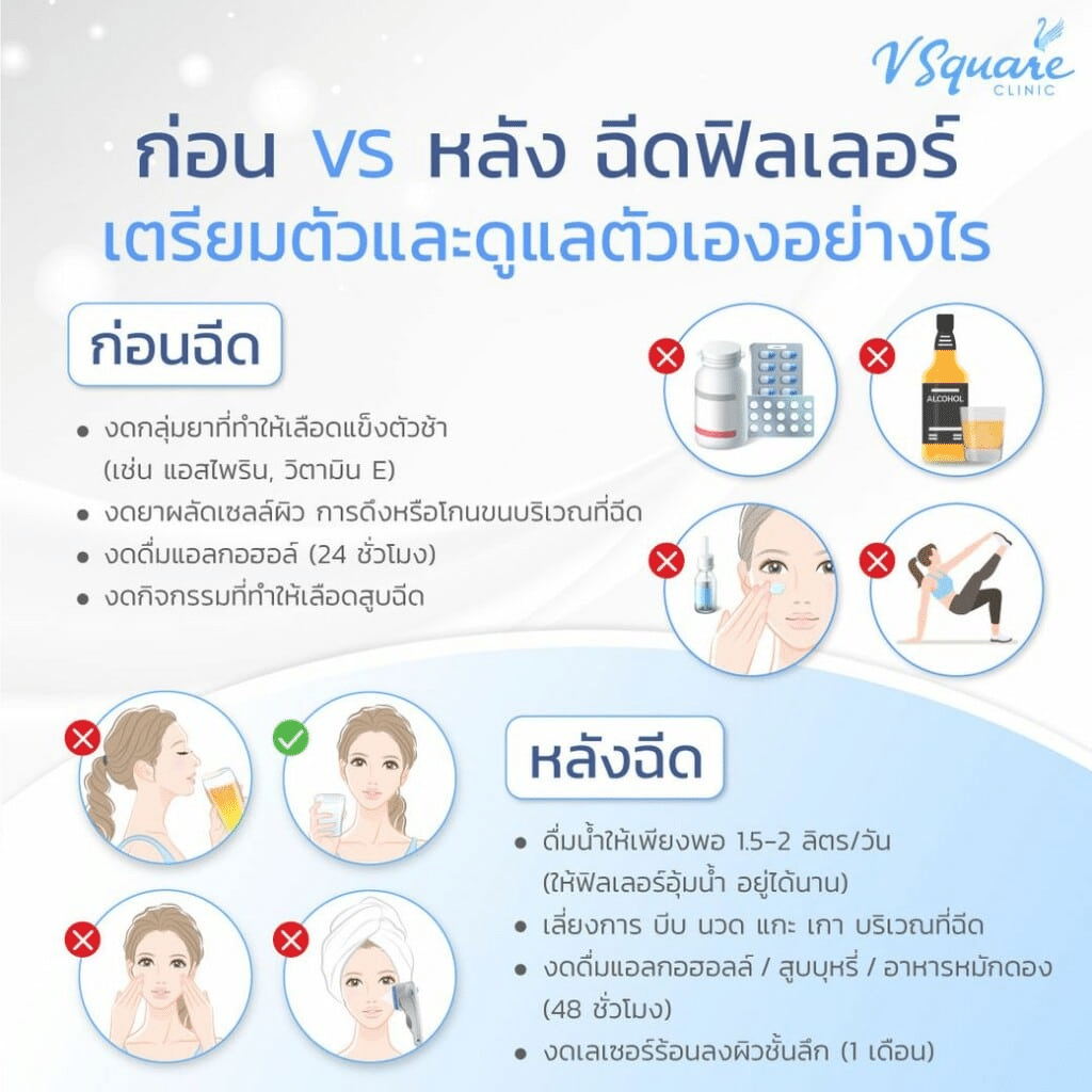 ก่อน-หลังฉีดฟิลเลอร์