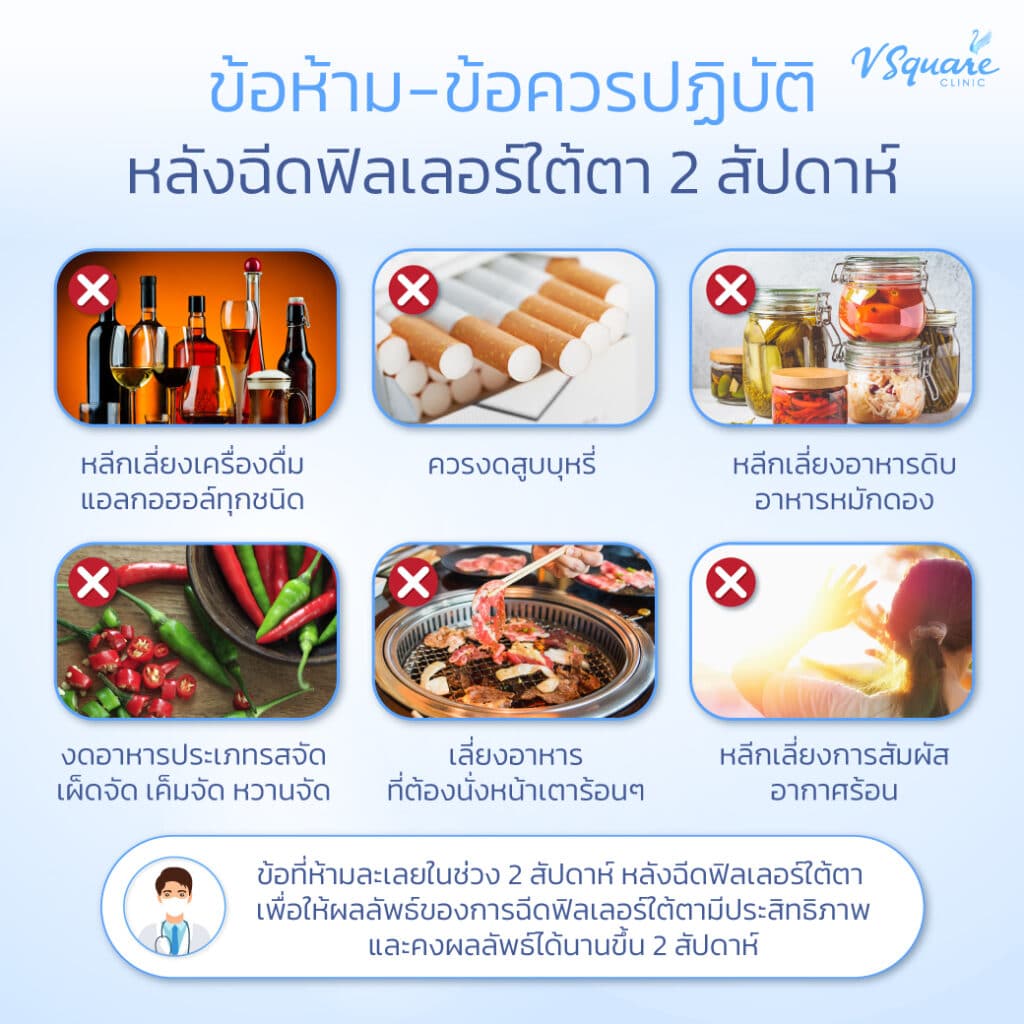 ข้อห้ามหลังฉีดฟิลเลอร์ใต้ตา