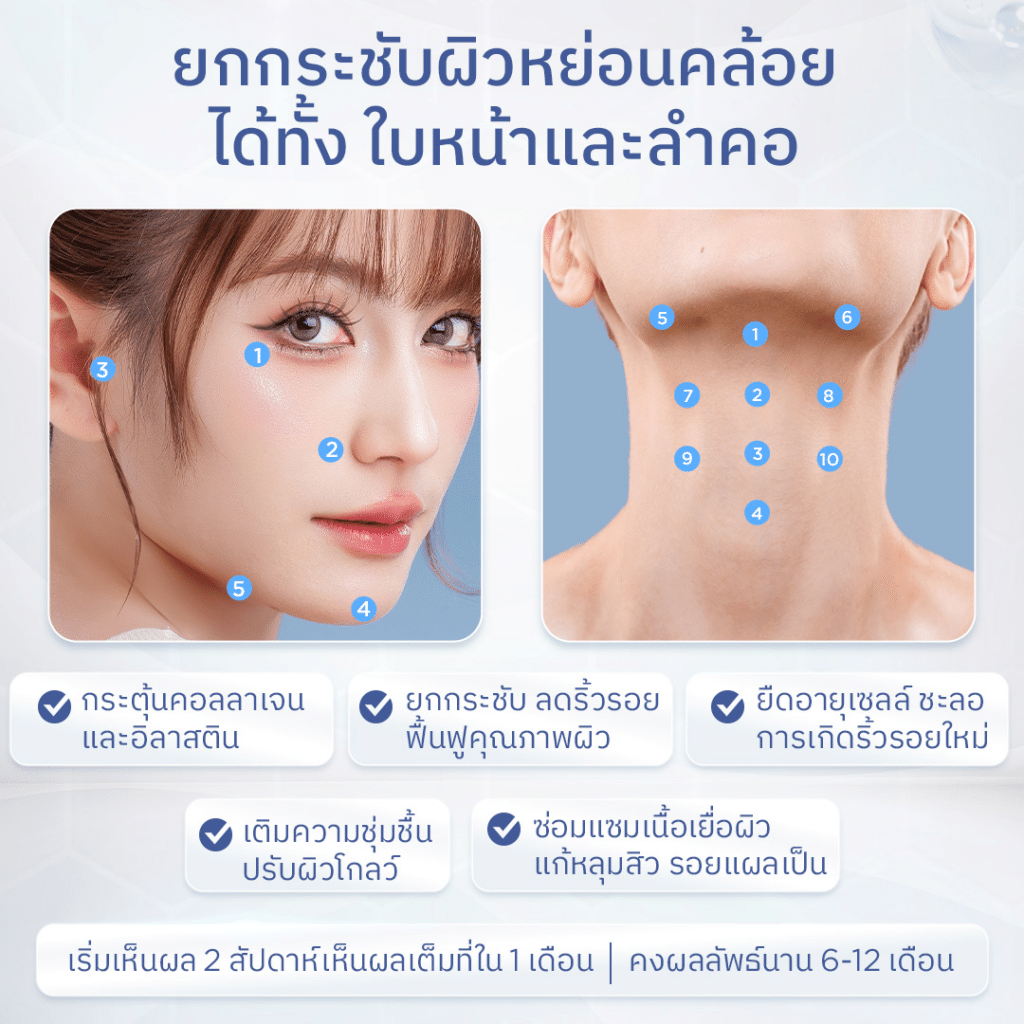 จุดเด่น Profhilo