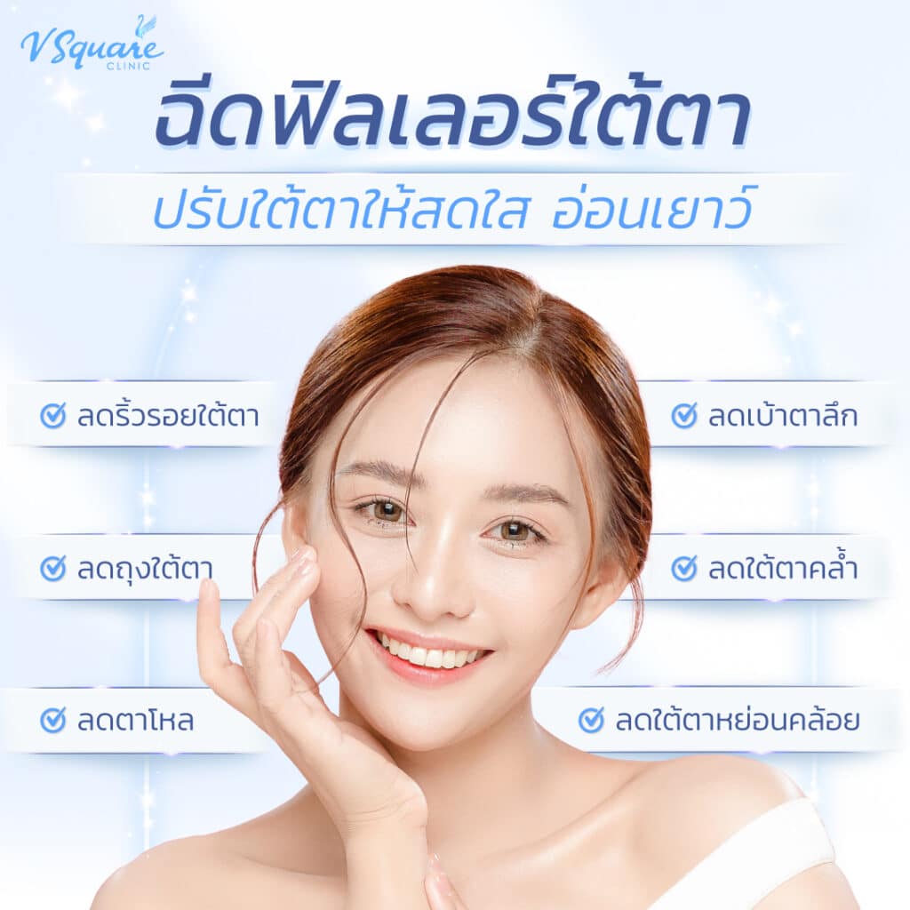 ฉีดฟิลเลอร์ใต้ตา