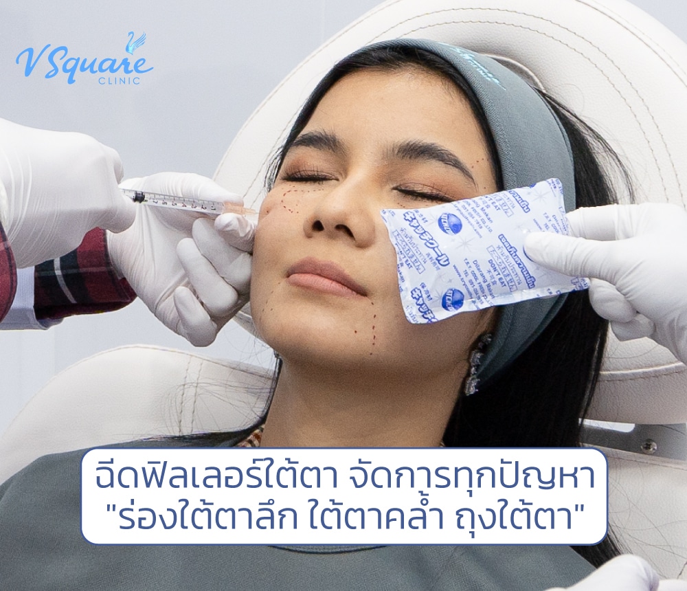 ฉีดฟิลเลอร์ใต้ตา