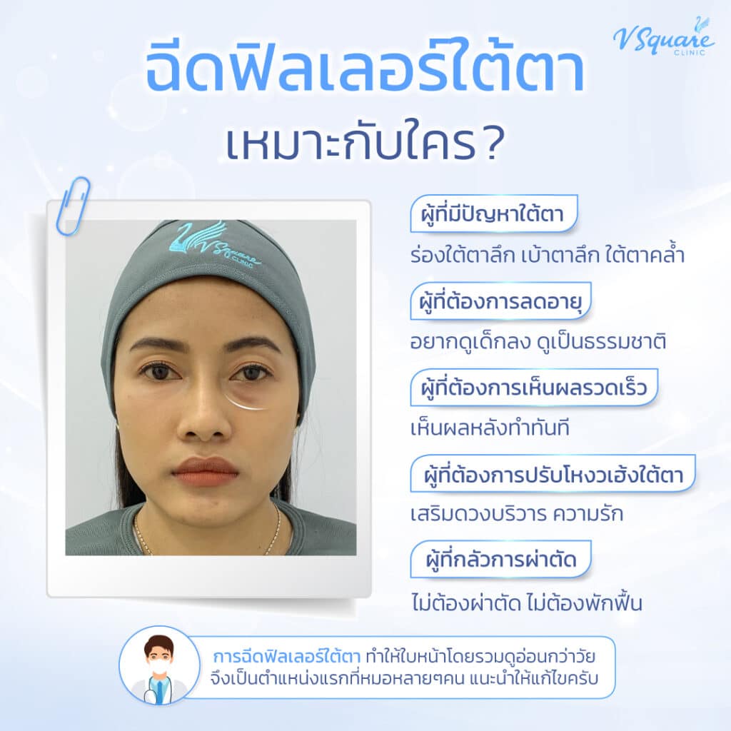 ฟิลเลอร์ใต้ตา เหมาะกับใคร
